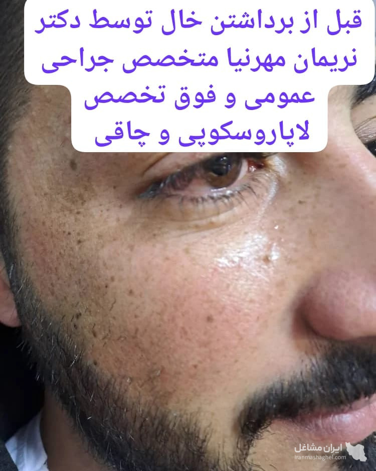 مطب تخصصی پوست و مو دکتر نریمان مهرنیا در تهرانپارس تهران
